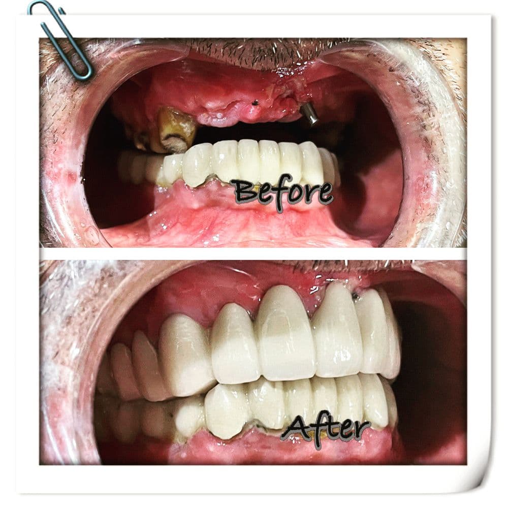 Treatment Result