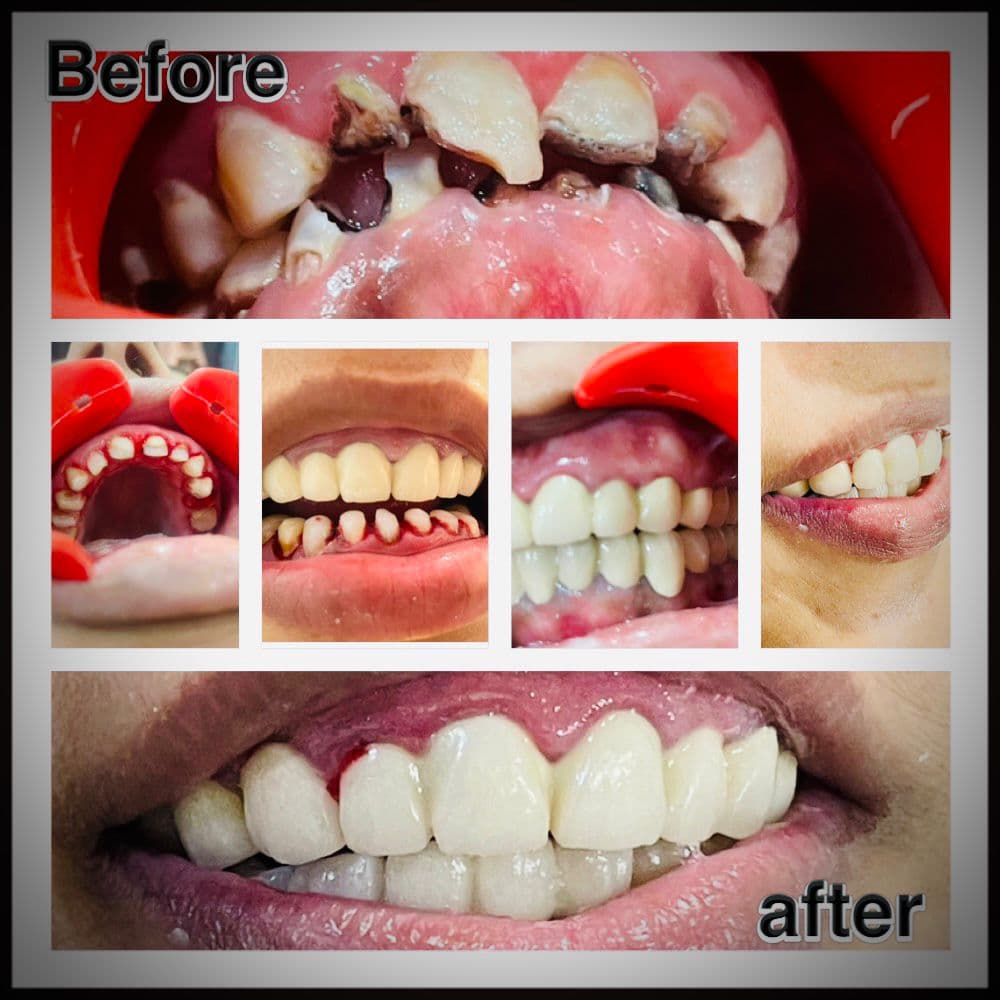 Treatment Result