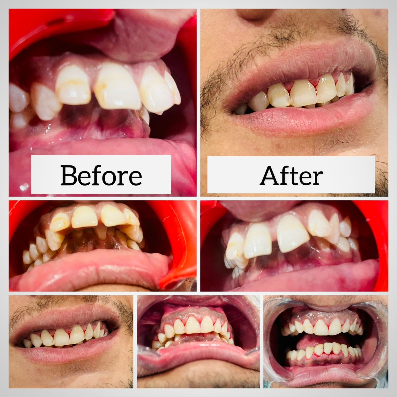 Treatment Result