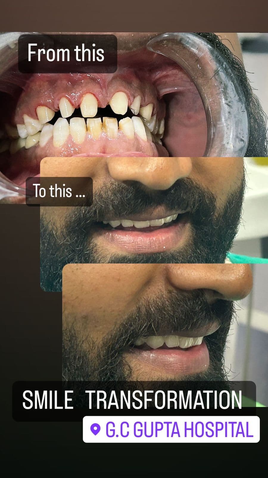 Treatment Result