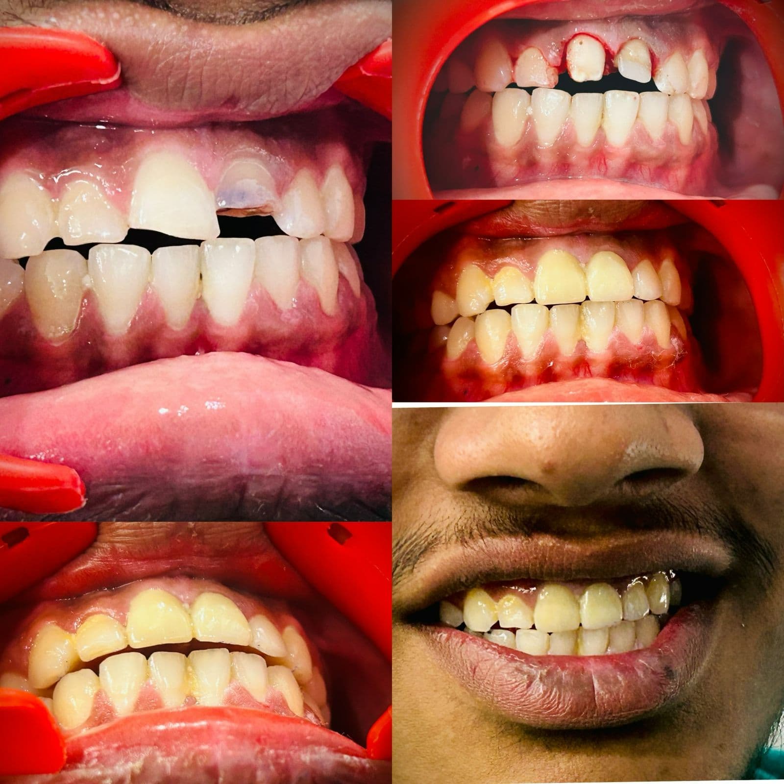Treatment Result