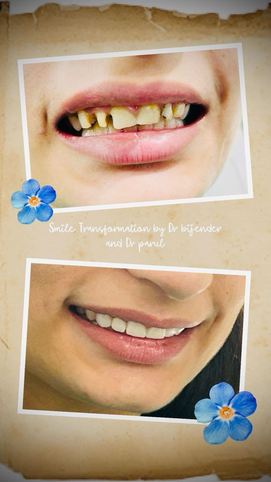 Treatment Result