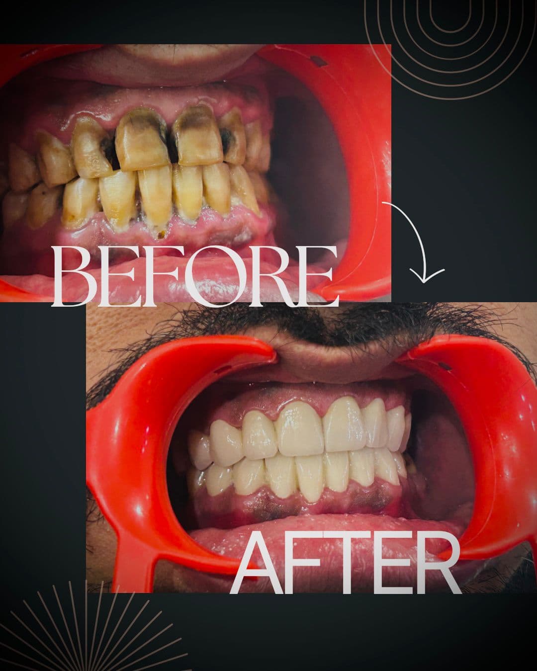Treatment Result