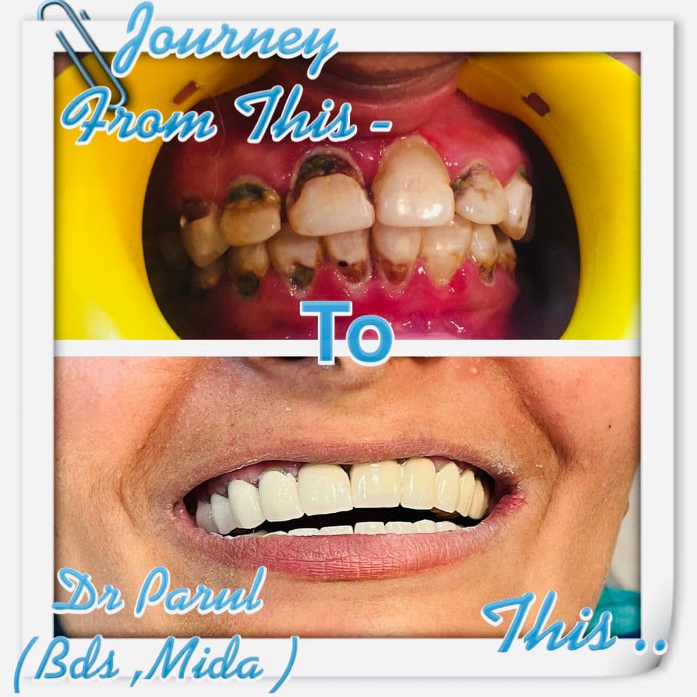 Treatment Result