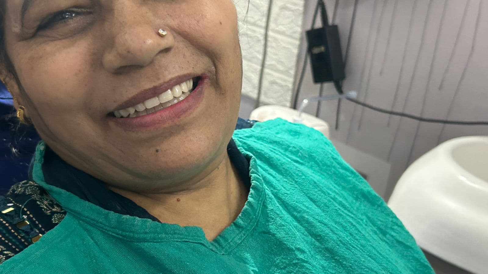 Smile Transformation