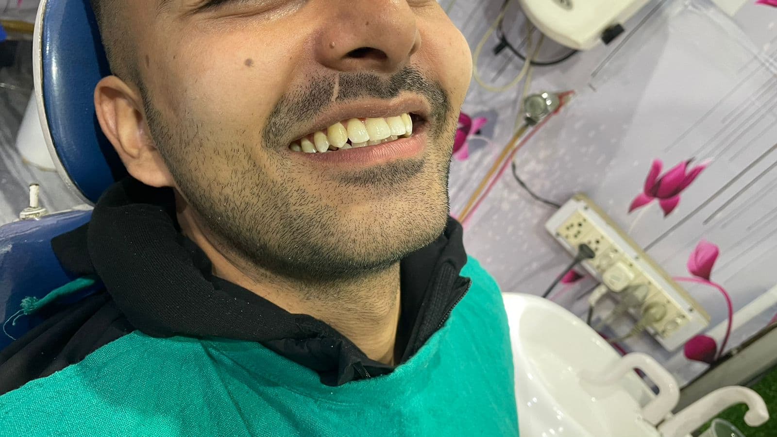 Smile Transformation