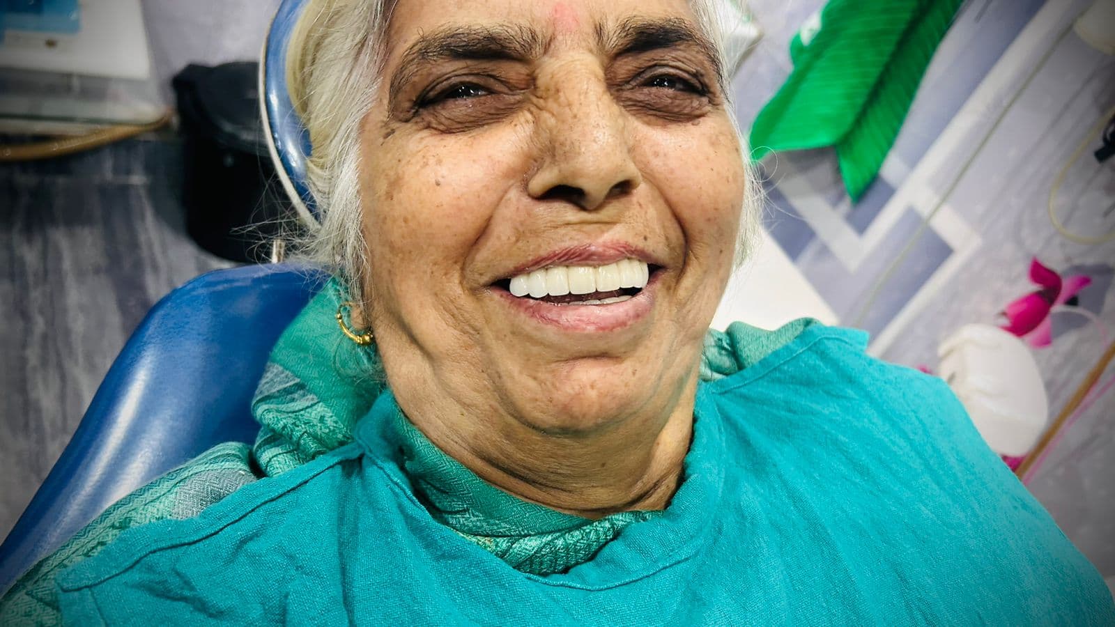 Smile Transformation